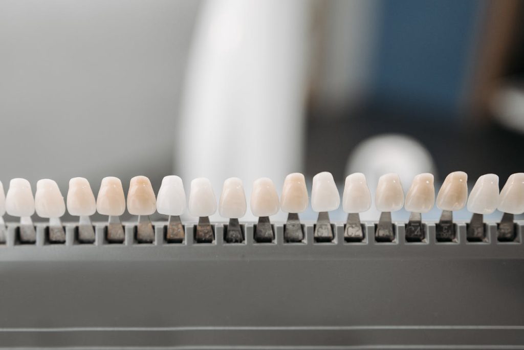 Quelles différences entre facette en céramique et facette en composite ?