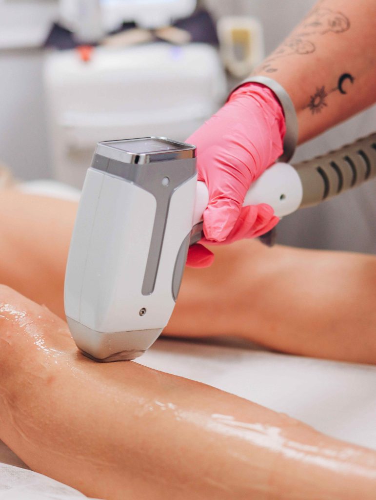 Épilation laser à Brest : 3 secrets pour une peau lisse et douce toute l’année